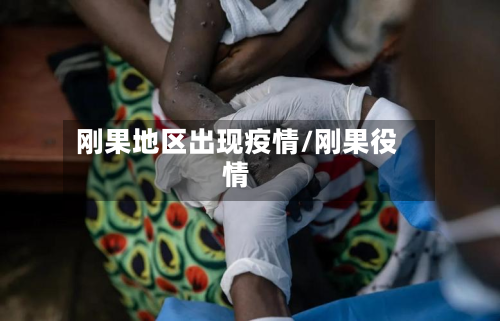 刚果地区出现疫情/刚果役情-第2张图片