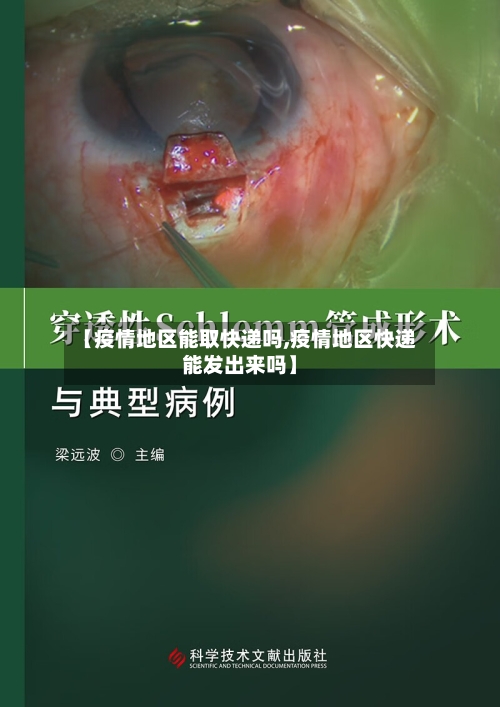 【疫情地区能取快递吗,疫情地区快递能发出来吗】