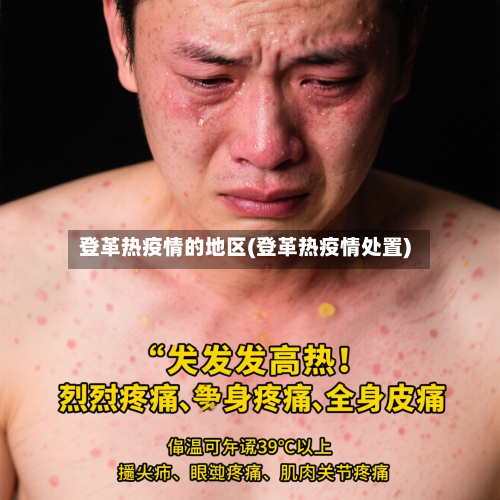 登革热疫情的地区(登革热疫情处置)-第2张图片